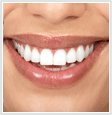 Image of white smile